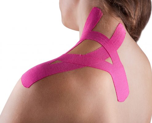 woman-with-kinesio-tape-on-shoulders-and-neck-495x400